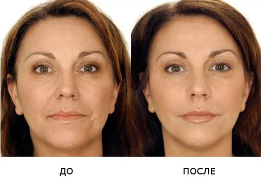 Slider image (5) Coolaser Clinic